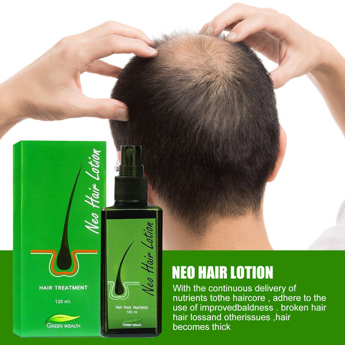 Hair Care Growth Lotion Spray Anti Hair loss